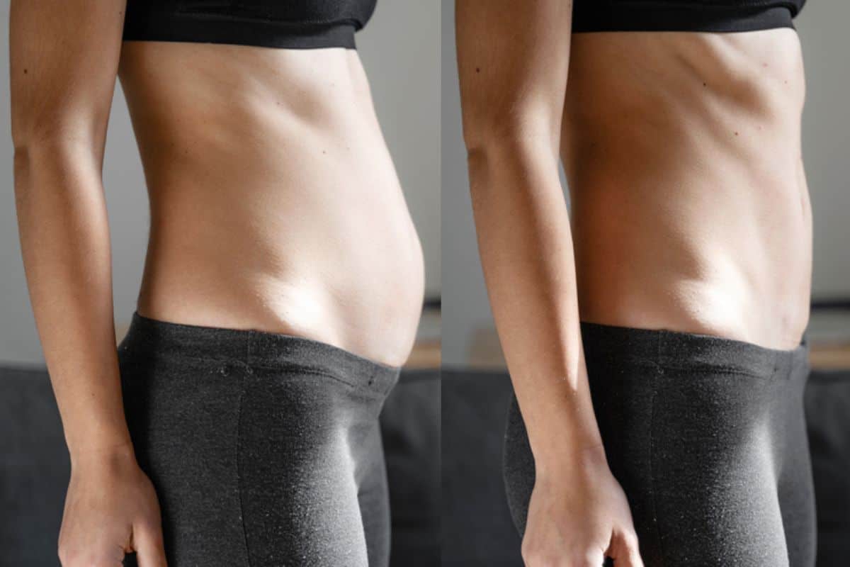 Post-Pregnancy: What Happens to Your Abdominal Muscles After Birth Ramsey