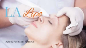 Woman receiving Actinic Keratosis Removal Treatment Ramsey