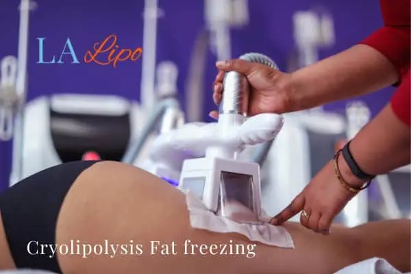 women getting fat freezing Ramsey