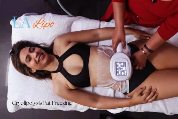 woman getting cryolipolysis Ramsey