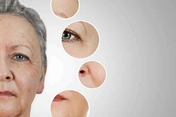 HIFU Facelift Ramsey from LA LIPO