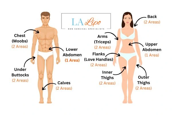LA LIPO Cryolipolysis Areas Ramsey