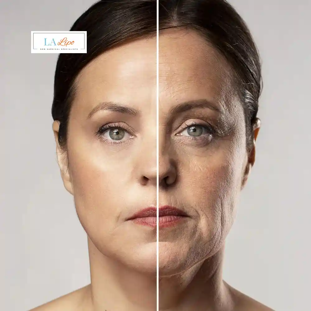 How Can You Tell If Non-Surgical Skin Tightening Is Right for You Ramsey?