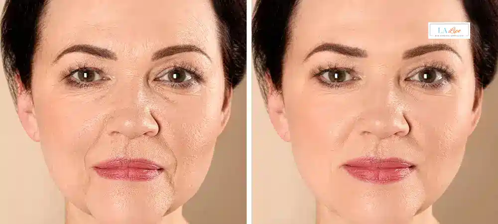 How Long Does It Take to See Results and How Long Do They Last Ramsey?
