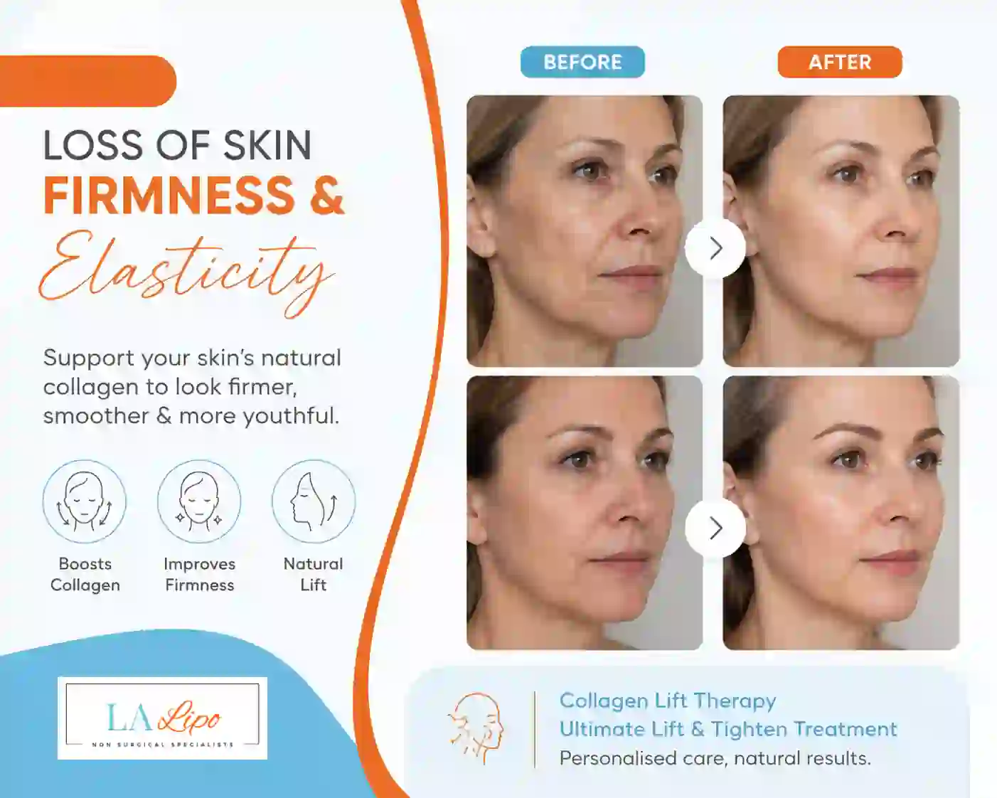 Sign #7: Loss of Skin Firmness and Elasticity Ramsey