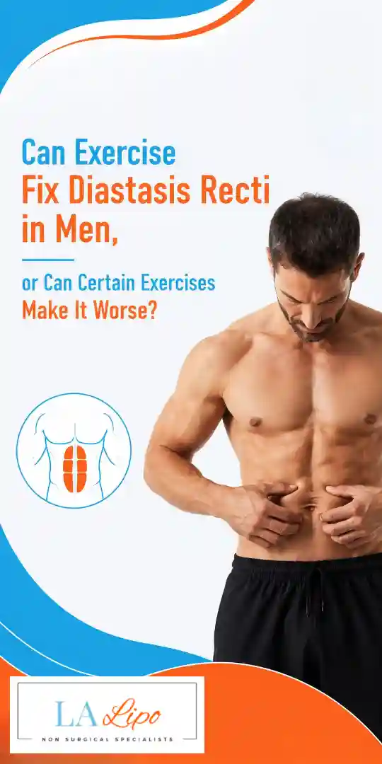 Can Exercise Fix Diastasis Recti in Men, or Can Certain Exercises Make It Worse Ramsey?